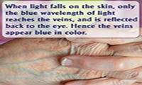 رگ‌های بدن به چه علت آبی به نظر می‌رسند؟