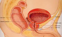  بیماری‌های غده‌ی پروستات